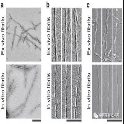 阿爾茨海默（mò）症（zhèng）研究：β澱粉（fěn）樣蛋白原纖維結構揭開